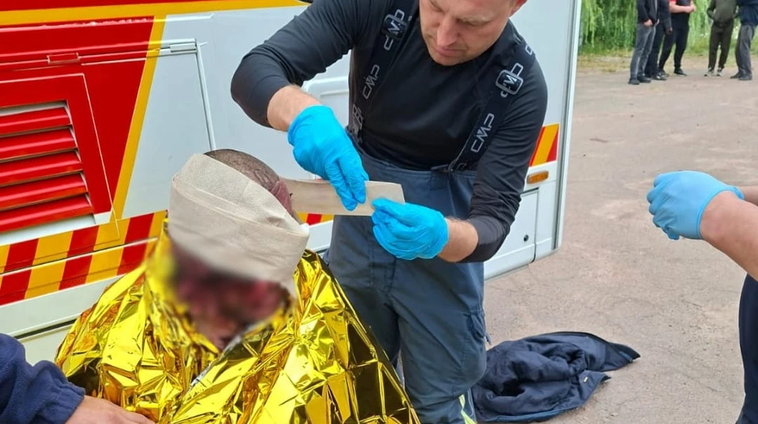 Лікарі надають першу необхідну медичну допомогу постраждалому внаслідок російської атаки на Житомирщині, 30 липня 2026 року